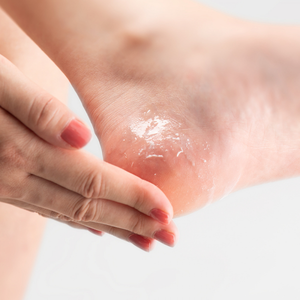 footy 薬用フットポロポロジェル(医薬部外品)