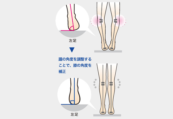 アーチフィッターインソール お悩み膝用 | O脚、膝痛を解決するインソール | AKAISHI 公式通販