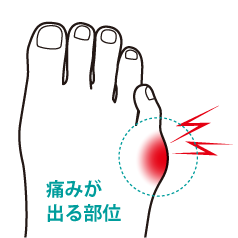 内反小趾におすすめの靴 Akaishi 公式通販